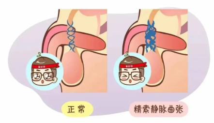 嚴(yán)重會(huì)不育！小伙精子質(zhì)量異常，元兇竟是它
